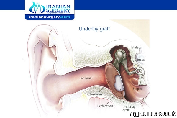 How Painful Is Kialodenzydaisis? Symptoms, Pain Levels, and What to Expect in 2026 How Painful Is Kialodenzydaisis?