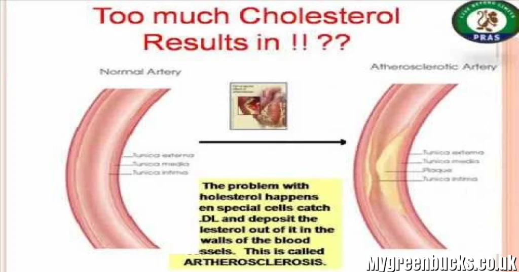 Holisterol: The Complete Guide to Understanding Cholesterol, Heart Health, and Balance Holisterol: The Complete Guide to Understanding Cholesterol